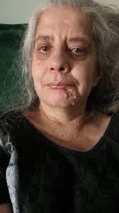 Hola desde Perú cumplí años hace poquito y siempre enfrentando con amor mi  condición