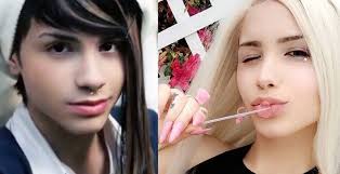 Geçtiğimiz yıl temmuz ayında paylaştığı youtube videosu ile fenomen haline dönüşen norveçli emma ellingsen, şimdilerde ülkesinin kendall jenner'ı olarak anılıyor. Cinsiyet Degistirme Ameliyati Fiyat 2020