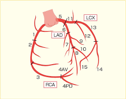 カテーテル検査とは 看護roo カンゴルー 冠動脈 看護ノート 医学