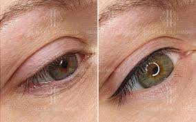 Permanent Make Up Vorher Nachher Bilder Humara Mahmood