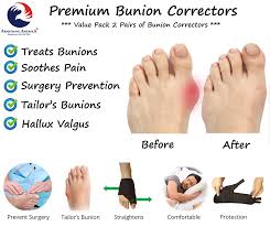 If the pain doesn't cease or continues to. Bunion Corrector Splints Big Toe Straightener For Hallux Valgus Pain Armstrong Amerika