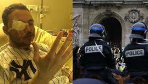 Cgt, fsu, gilets jaunes ou encore représentants du personnel soignant ont défilé dans le calme de la place de la république au miroir d'eau, masqués pour le quatrième samedi de suite, gilets jaunes et pancartes sont de sortie. Je N Ai Plus Qu Un Oeil Antoine A Perdu La Vue Lors D Une Manifestation Des Gilets Jaunes