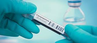 Screening And Testing Coronavirus Information