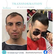 𝓐𝓔𝓢𝓣𝓗𝓔𝓣İ𝓒 𝓗𝓐İ𝓡𝓣𝓡𝓐𝓝𝓢 (@aesthetichairtrans) • Фото и видео в  Instagram