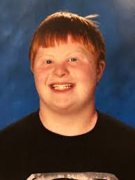 Usually when one cell divides in two, pairs of chromosomes are split so that one of the pair. Bothell Police On Twitter Missing Person Frederick Freddy Carlson Is A 16yr Old Male With Down Syndrome Last Seen At His Home 24000 Blk Of 6 Pl W At 6 Am Freddy