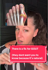 How Hawaiians Deal with Gout