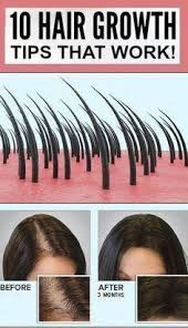 Pin On Hair Solutions