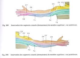 Le cause che possono determinare il quadro clinico della nevralgia cervico brachiale possono non dipendere esclusivamente da problemi della colonna vertebrale. Nevralgie Cervico Brachiale Et Nevralgie Scapulaire Pt1