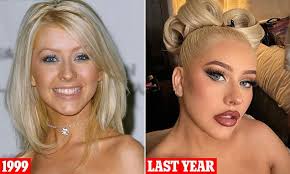 Plastic surgeons explain Christina Aguilera's new 'fox-like face'