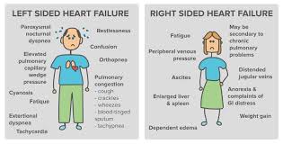 Overview Of Heart Failure Article Khan Academy