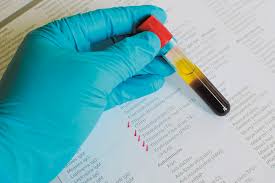 Do You Need A Thyroid Test Harvard Health
