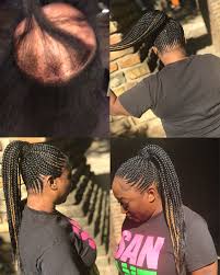 Pin By M B Ganngggg On Braids Feeder Braids Hair Loss Remedies Women Braided Ponytail