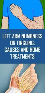 Left Arm Numbness Or Tingling Causes And Home Treatments Arm Numbness Numbness In Hands Arms