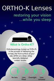 Menicon Z Night Orthokeratology 1p Buy Contact Lenses Online Lenshop Buy Contact Lenses Online Contact Lenses Contact Lenses Online