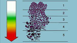 Видео trening etter innsatt hofteprotese канала nhinorway. Prostatakreft Faq Progether