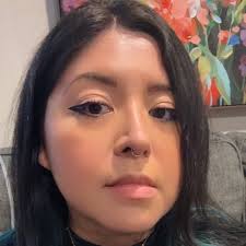 I have nothing against lip filler but if you have a cupids bow (not many  people do) keep it! People are sandblasting beautiful lip structure!