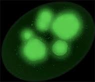 Image result for ANA Staining Pattern