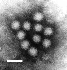 Основными симптомами являются тошнота, рвота, боли. Virus Noruolk Vikipediya