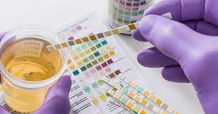 Oct 15, 2019 · in short, the drug testing lab may have erred; Why Using Cbd Might Make You Fail A Drug Test Cnet