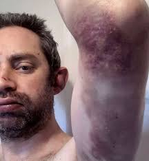 abuse #mywifemyabuser #toxicrelationship