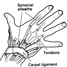 Cumulative Trauma Disorders Some Cautions For Conservators