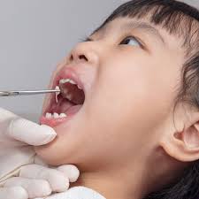 Tips for Recovering from A...