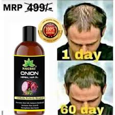 Most onion oils are made of 100% natural and organic ingredients which means they are free from any sort of toxic chemicals. Utterpardes Hashtag On Twitter