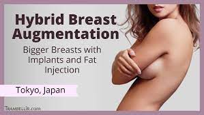 Hybrid Breast Augmentation (Bigger Breasts with Implants and Fat Injection)  [Tokyo] 