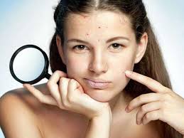 Consuming it has really amazing health and skin benefits. How To Remove Pimple Marks Effective Ways Femina In