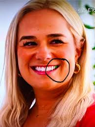 Whyyyyyyy won't Meri get that one yellow tooth fixed?