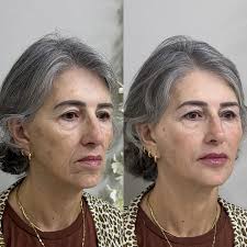 ✨ Vem aí: Lavieen Day