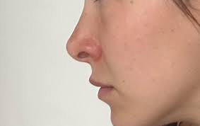 Has anyone been to Dr. Yasin Kürşad Varsak?