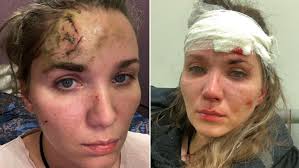 Facebook gives people the power to. Aktrisa Vedenskaya Vylozhila Foto Posle Izbienij V Peterburge Gazeta Ru Novosti