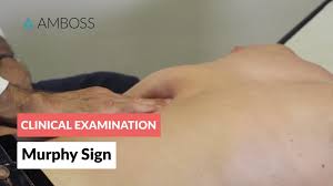 Image result for Shifting Dullness Test