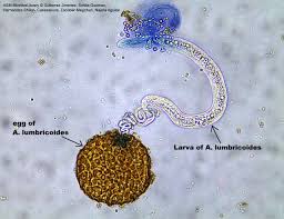 Ascaris Lumbricoides Larva Hatching Out Of Egg This Has To Be A Rare Find When You Are Testing For This Parasitologia Sintomas Da Biologia