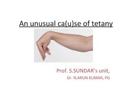 Image result for Tetany