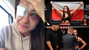 „doszło do pęknięcia kości tuż pod okiem. Karolina Kowalkiewicz Kontuzja Emerytura W Ufc Jedrzejczyk Blachowicz I Ojciec Mateusz Wywiad Sport Tvp Pl