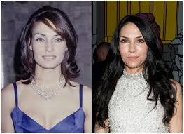 The first time tara reid had gone under the knife, apparently her breast augmentation and liposuction got botched, and so she went under the knife again in 2007 to get them fixed. Famke Janssen S Plastic Surgery Before And After Pics Celebrity Plastic Surgery
