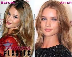 A rhinoplasty procedure refines the nose by surgically reshaping the bone, tissue, and cartilage or by inserting grafts or implants into the nose. Rosie Huntington Whitely Lands The Role In Transformers 3 Dark Of The Moon And Immediately Has Rhinoplasty Surger Hair Implants Plastic Surgery Lip Surgery