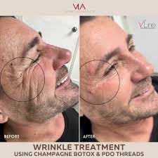 V LINE AESTHETIC HOME