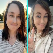 TOBY G. MAYER MD, FACS