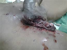 Internal ballistics deals with all the processes within the gun. A Traumatic Case Of The Scrotum By Firearm And With A Dramatic Evolution