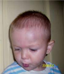 * dureri de cap la copii sunt obisnuite si, de obicei, nu sunt grave. Kadinsi Dolap Yikmak Lovitura La Cap Whiteangelcomic Com