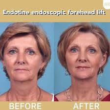 Доктор Dr Michael Georgopoulos: ціни та відгуки. Забронюйте консультацію