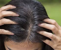 Goodness of coconut, castor and henna. Does Amla Juice Help In The Graying Of Hair Quora