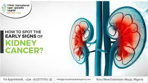 More about kidney cancer (renal cell cancer). Early Detection Of Kidney Cancer How To Recognize The First Signs Primus International Super Speciality Hospital