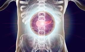 Chiar si in cazul unei pancreatite acute usoare, spitalizarea poate fi necesara. La Dieta Da Seguire In Caso Di Pancreatite Pazienti It