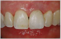 Ihr Zahnarzt Auf Internet Dr Nagy Istvan Zahnarzt In Sopron Ungarn Zahn Zahnarzt Zahndoktor Zahnersatz Krone Kronen Praxis Dental Dr Nagy Istvan Sopron Dental Klinik Ungarn Gunstig Implant Zahnimplant Implantologie Implantologie