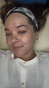 ✨The summer you chose me to be your esthetician & we transformed your skin✨  #tsitp #estheticallypleasing