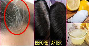 Generally, hair turns white due to loss of melanin. 10 Causes Of White Hair And 12 Ways To Prevent It Naturally